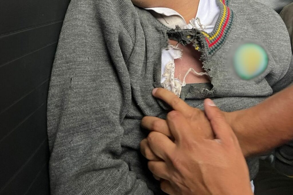 Quito: Estudiante murió tras ser alcanzado por un rayo durante tormenta eléctrica