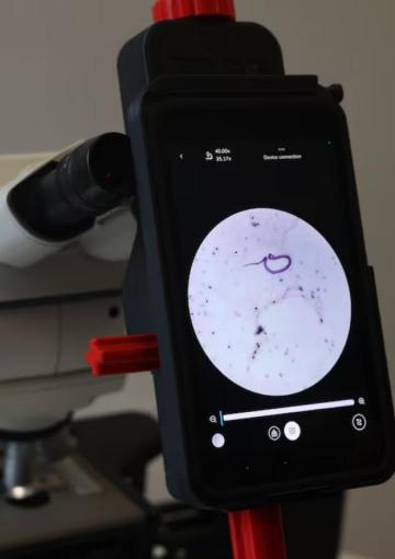 ¡Imágenes! Estas son tres noticias positivas que dejó el 2025 en el mundo 4 Un 'filtro' con IA para detectar la malaria en África:
. Este 2025 entró en fase de validación el proyecto MultiplexAI, liderado por instituciones europeas y africanas que convierte un microscopio en un dispositivo capaz de detectar enfermedades como la malaria.
. Tal como un 'filtro', el celular captura la imagen de la muestra de sangre del paciente y detecta todas las enfermedades que tiene.
. Su uso no requiere internet y es una ventaja para comunidades sin acceso a especialistas del área de la salud.